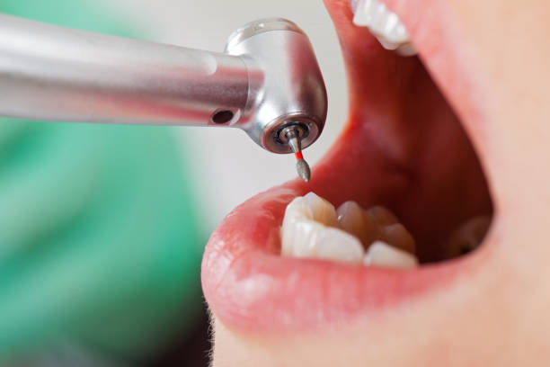 Best Emergency Treatment for Oral Infections in Central, LA